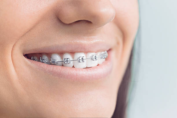 Best Tooth Extraction  in Wharton, TX